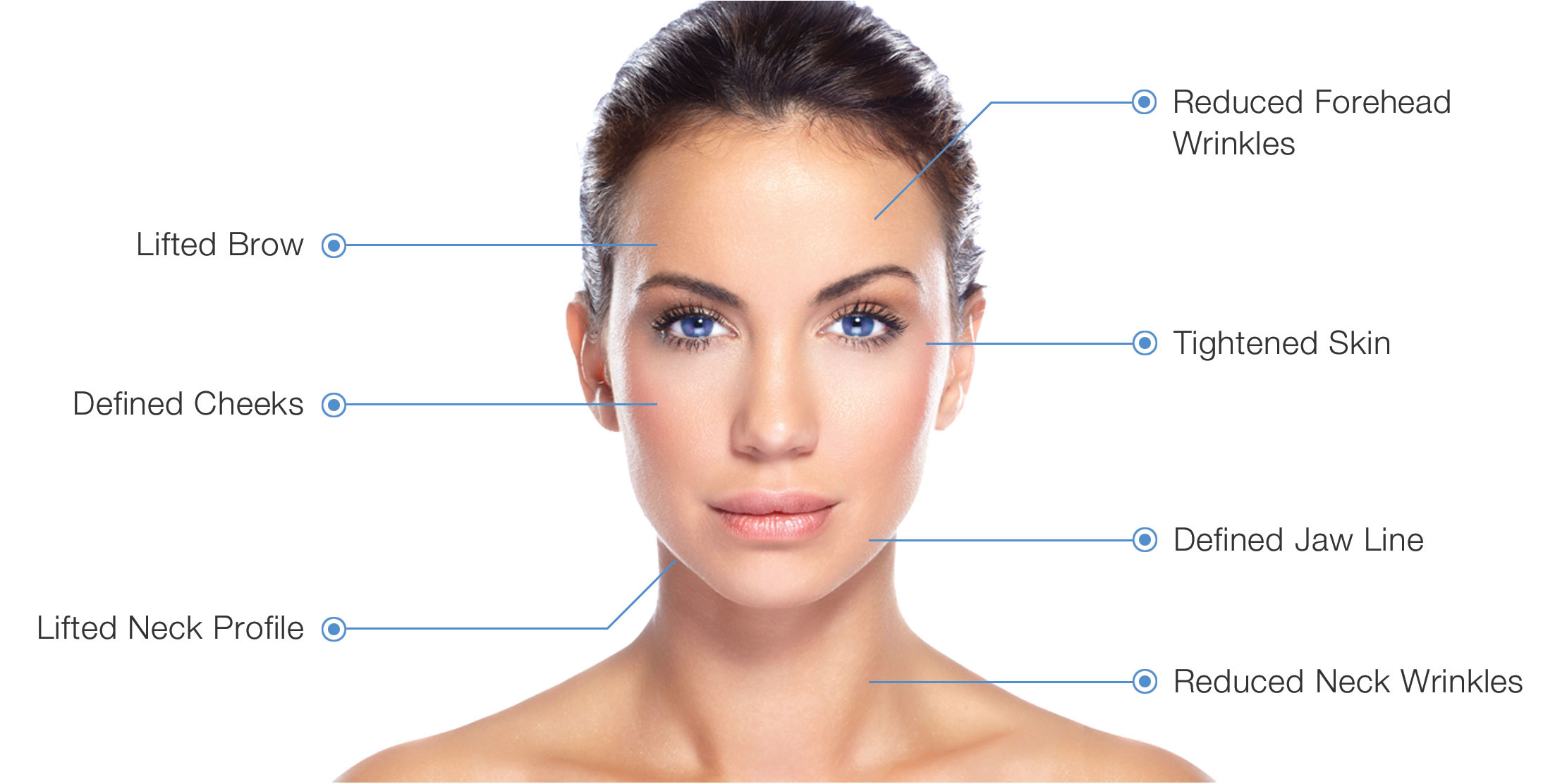 What is Profhilo - Skin tightening in London?